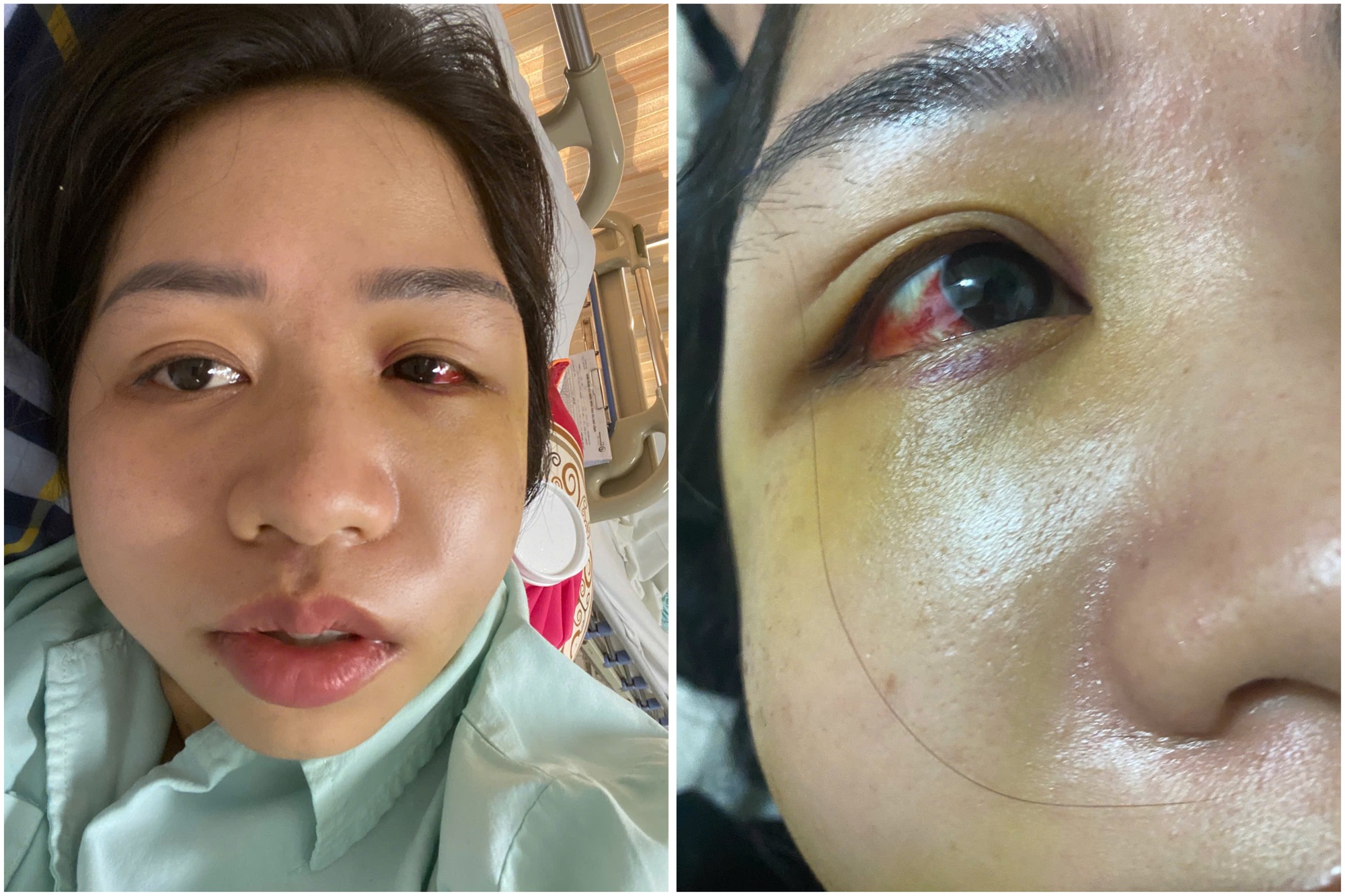 Lào Cai: Rắc rối chuyện đền bù khi chó chạy ra đường gây tai nạn- Ảnh 1.