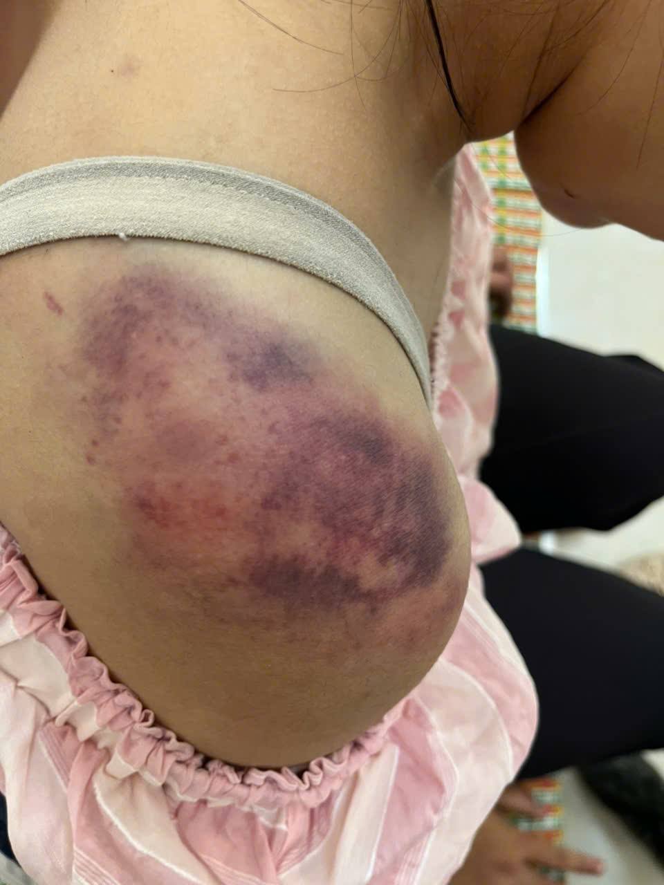 Hé lộ nguyên nhân vụ bé gái 13 tuổi bị ông bà bạo hành ở Thái Nguyên- Ảnh 2. Hé lộ nguyên nhân vụ bé gái 13 tuổi bị ông bà bạo hành ở Thái Nguyên- Ảnh 2.