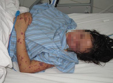 Chuyên gia khuyến nghị gì về bệnh truyền nhiễm có thể gây tử vong trong 24 giờ?- Ảnh 1.