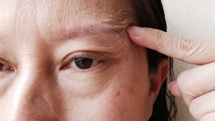 Liệt dây thần kinh số 7: Dấu hiệu, nguyên nhân và cách điều trị hồi phục nhanh- Ảnh 4. Liệt dây thần kinh số 7: Dấu hiệu, nguyên nhân và cách điều trị hồi phục nhanh- Ảnh 4.