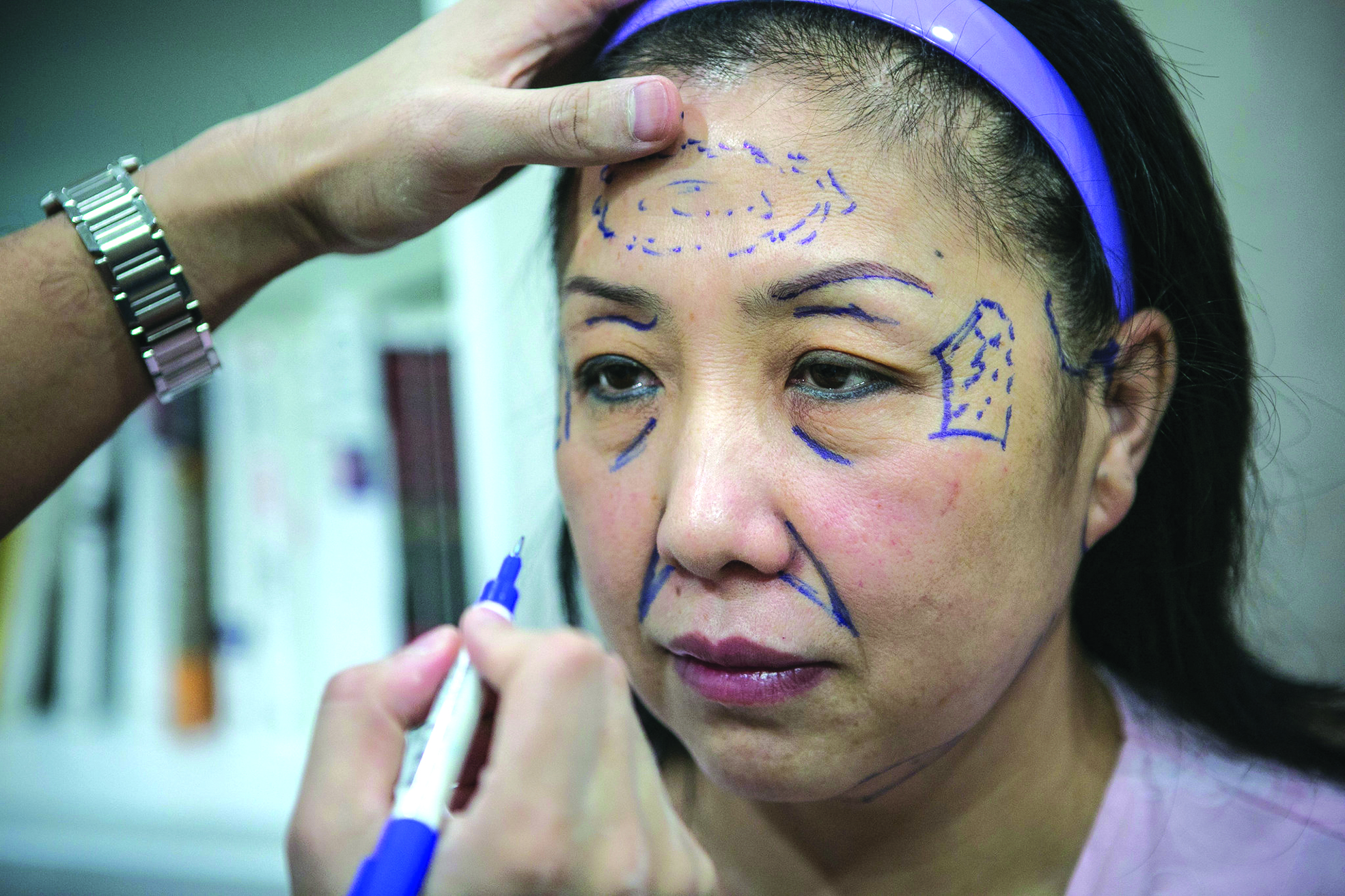Một du khách đến Hàn Quốc để phẫu thuật thẩm mỹ Một du khách đến Hàn Quốc để phẫu thuật thẩm mỹ