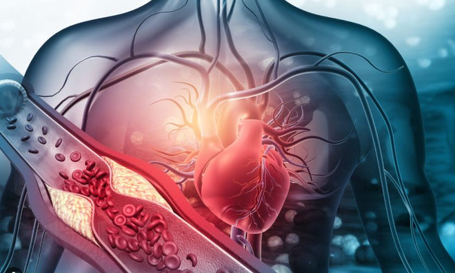 Vì sao hệ tim mạch dễ “quá tải” sau kỳ nghỉ Tết?- Ảnh 1.