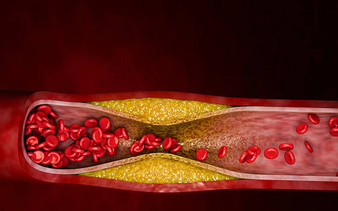 Những loại thực phẩm cần tránh nếu bạn có cholesterol cao- Ảnh 1.