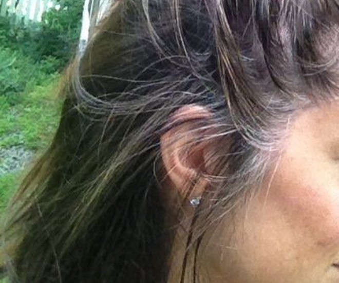 Vị trí tóc bạc phản ánh tình trạng sức khỏe của bạn như thế nào?- Ảnh 2.