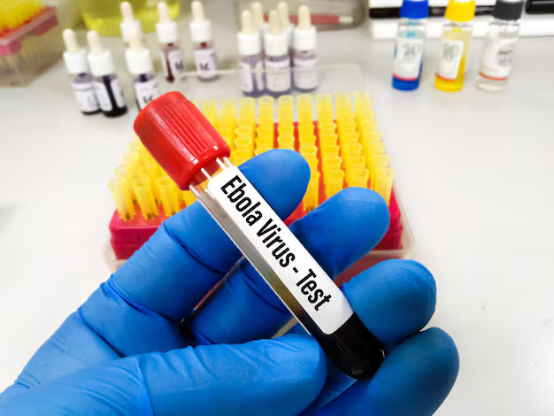 Bộ Y tế kích hoạt các biện pháp ứng phó nguy cơ Ebola xâm nhập Việt Nam- Ảnh 1. Bộ Y tế kích hoạt các biện pháp ứng phó nguy cơ Ebola xâm nhập Việt Nam- Ảnh 1.