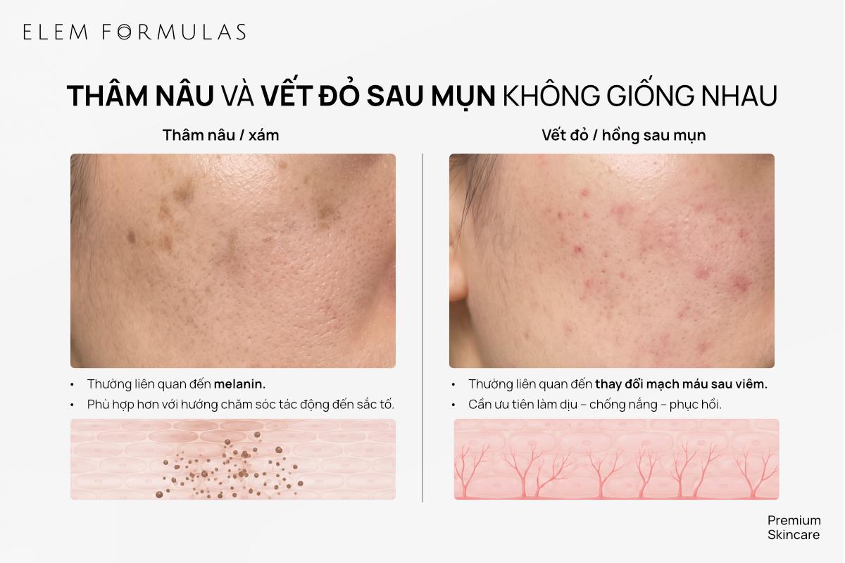 ELEM FORMULAS: Serum Autophagy hỗ trợ cải thiện thâm sau mụn và sắc tố- Ảnh 1.