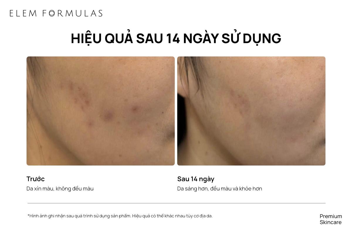 ELEM FORMULAS: Serum Autophagy hỗ trợ cải thiện thâm sau mụn và sắc tố- Ảnh 6.