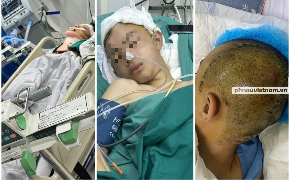 Nam sinh 14 tuổi bị truy tố tội Giết người: Tòa trả hồ sơ làm rõ dấu hiệu đồng phạm- Ảnh 1.