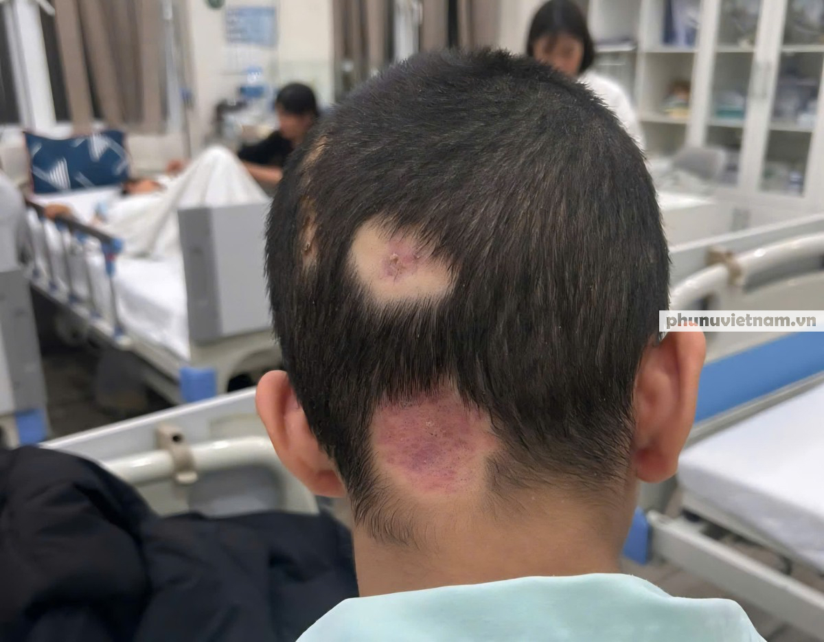 Nam sinh 14 tuổi bị truy tố tội Giết người: Tòa trả hồ sơ làm rõ dấu hiệu đồng phạm- Ảnh 3.