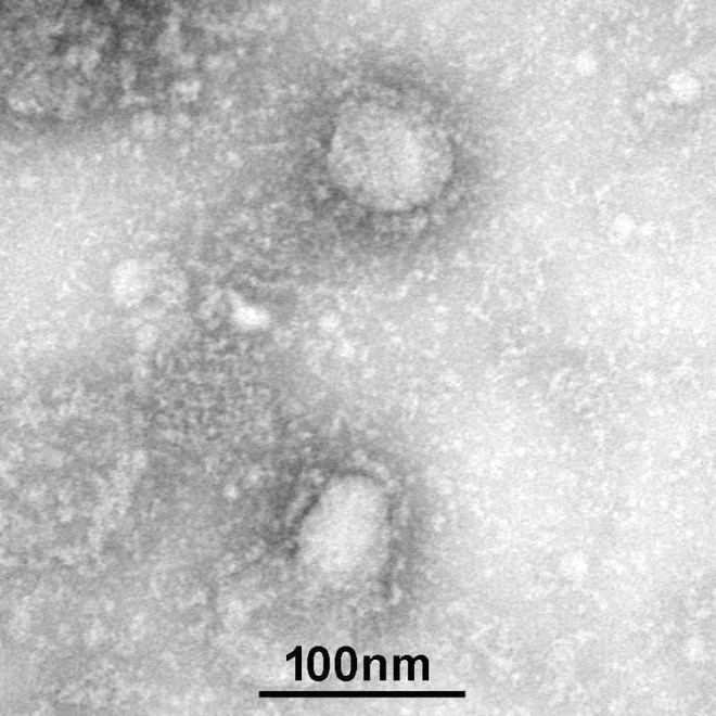 Công bố hình ảnh đầu tiên về virus corona - Ảnh 1.