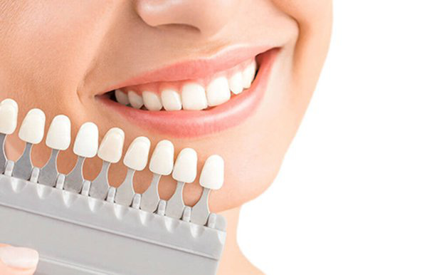 Bọc răng sứ thẩm mỹ để có hàm răng trắng và nụ cười hoàn hảo, nên hay không? - Ảnh 8.