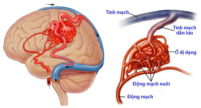 Ảnh 3.