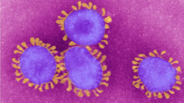 Vì sao nhiều lần xét nghiệm âm tính vẫn nhiễm virus Covid-19 ? - Ảnh 1.