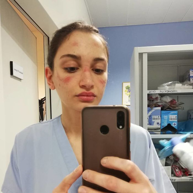 Y tá Alessia Bonari với gương mặt bơ phờ