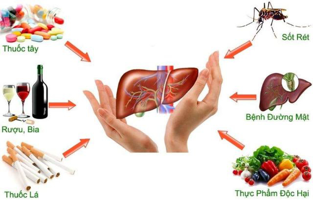 Những sai lầm khi điều trị xơ gan thường gặp - Ảnh 2.