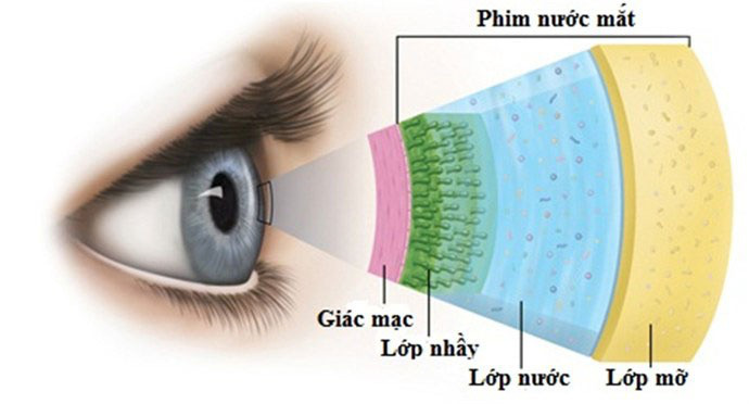 Bệnh khô mắt là gì-2