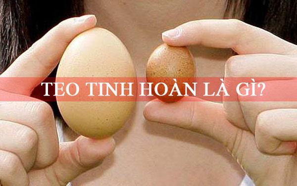 Teo tinh hoàn là gì? Nguyên nhân, dấu hiệu và cách điều trị - Ảnh 2.