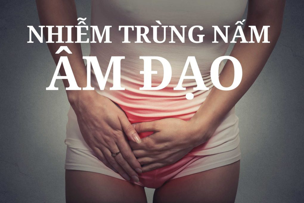 Tổng quan kiến thức về bệnh nấm âm đạo-1