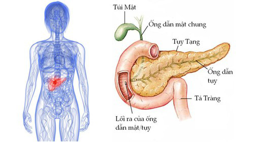 Tìm hiểu tổng quan về bệnh ung thư tuyến tụy - Ảnh 2.