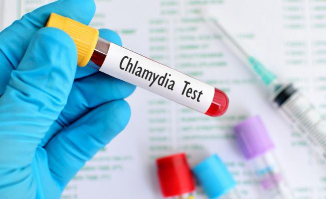 Chlamydia ở nam giới là gì và những điều cần biết - Ảnh 7.