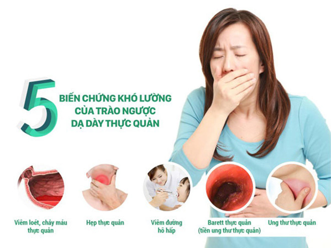 Những biến chứng trào ngược dạ dày thực quản nguy hiểm khi mang thai - Ảnh 3.