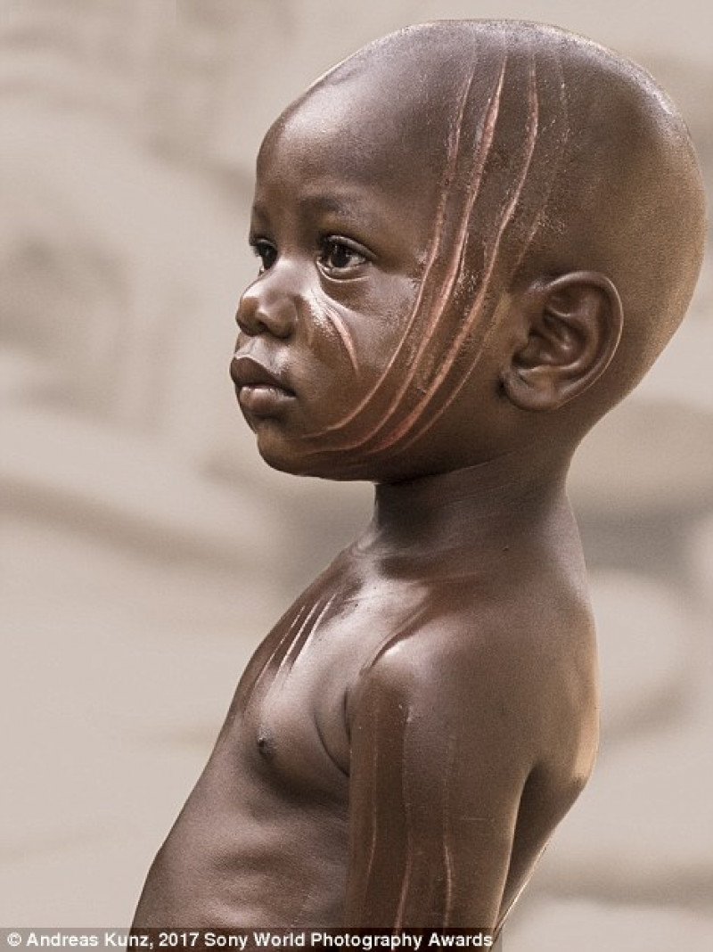 Một cậu bé mang những vết sẹo dài này đến từ quốc gia Togo, Tây Phi. Những vết sẹo của em là kết quả của nghi lễ đau đớn mà mỗi đứa trẻ 2 tuổi nơi đây đều phải trải qua. Đó cũng là dấu hiệu điển hình của bộ lạc Soma nơi đây. 