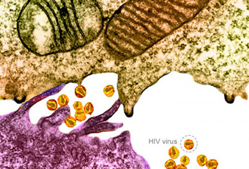 Suy giảm miễn dịch ở người (HIV): HIV là siêu vi gây ra AIDS. Nó lây lan qua đường máu khi tiếp xúc với với người bị bệnh, chẳng hạn như quan hệ tình dục không an toàn hoặc dùng chung kim tiêm. Phụ nữ mang thai nhiễm HIV có thể truyền sang con. Hiện nay vẫn chưa có thuốc hoặc vắc-xin chữa bệnh, nhưng việc điều trị sớm với thuốc chống HIV có thể giúp hệ miễn dịch chống lại virus gây bệnh.