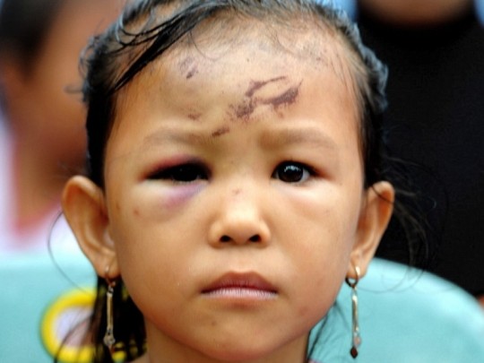 Những đứa trẻ vô gia cư sau động đất ở Indonesia
