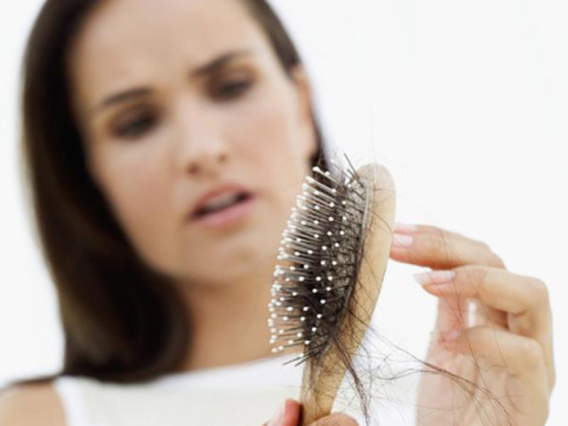 Rụng tóc: PCOS cũng có thể khiến tóc mỏng đi. Nếu đột nhiên bị rụng tóc quá nhiều, bạn nên khám bác sĩ để biết chính xác nguyên nhân.