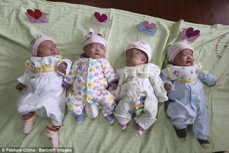 Điều kỳ lạ là 4 bé gái giống nhau như đúc khiến cả gia đình và bác sĩ tròn mắt ngạc nhiên. Đây được xem là trường hợp cực kỳ hiếm vì trong 15 triệu ca sinh mới có 1 ca như vậy. Thậm chí trên thế giới hiện mới có chưa đến 100 ca đặc biệt như vậy. 