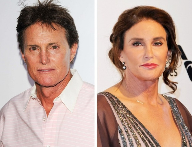 Phẫu thuật chuyển giới từ nam sang nữ của Caitlyn Jenner - chồng cũ của Kris Jenner đã phải tốn 60.000 USD. Caitlyn đã phẫu thuật nâng ngực, bỏ yết hầu, cắt bớt xương hàm để có thể mang thân hình của một người phụ nữ.