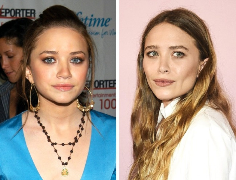 Ngày trước, thật khó để người ta có thể phân biệt được hai chị em sinh đôi nhà Olsen. Thế nhưng gần đây, Mary-Kate Olsen càng khiến fan sửng sốt vì ngoại hình thay đổi do phẫu thuật thẩm mỹ: môi không còn căng mọng tự nhiên, chiếc mũi nhỏ hơn và xương gò má thì cao hơn.