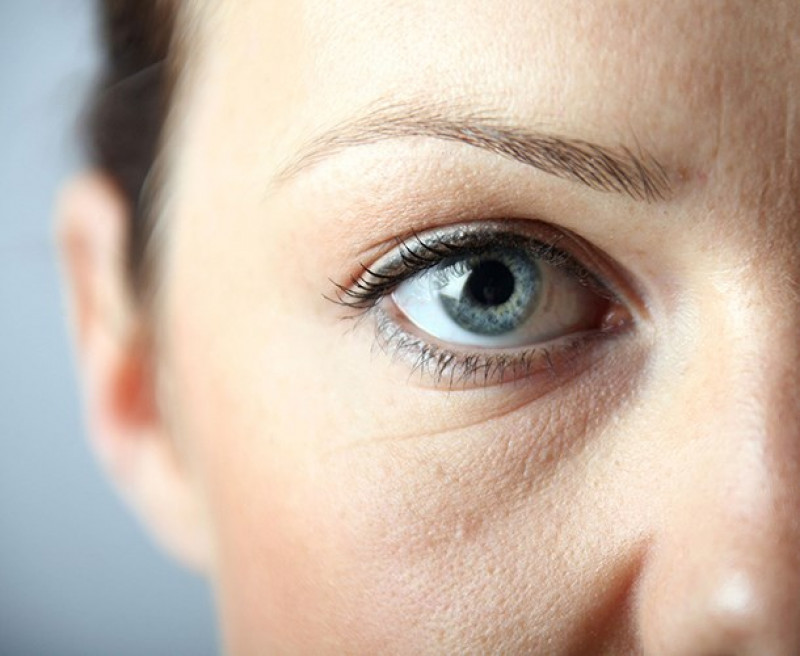 Bọng mắt và quầng thâm có thể là do di truyền, thiếu ngủ, chế độ dinh dưỡng, cơ thể mệt mỏi, tuổi tác… Ngoài ra, đôi mắt mệt mỏi cũng có thể là một dấu hiệu cảnh báo các bệnh dị ứng mãn tính, làm giãn mạch máu.