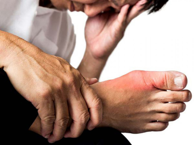 Tăng nguy cơ mắc bệnh Gout: Gout là một bệnh tương tự như viêm khớp gây ra do sự tích tụ dư thừa acid uric. Caffeine làm tăng nguy cơ mắc bệnh này. Vì chất kích thích này là thuốc lợi tiểu, nó sẽ loại bỏ được rất nhiều chất lỏng từ cơ thể và khiến axit uric không thể hòa tan. Điều này dẫn đến sự lắng đọng các axit uric trong các khớp dẫn đến làm tăng nguy cơ bệnh gout.