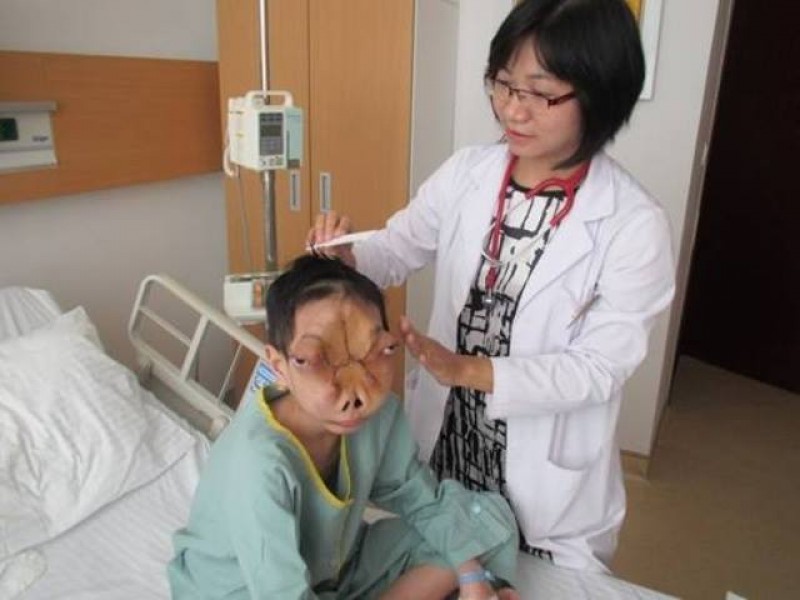 Năm 2013, Tuấn được các bác sĩ BV Vinmec cùng GS Mc Kay McKinnon phẫu thuật loại bỏ được khối u. 
