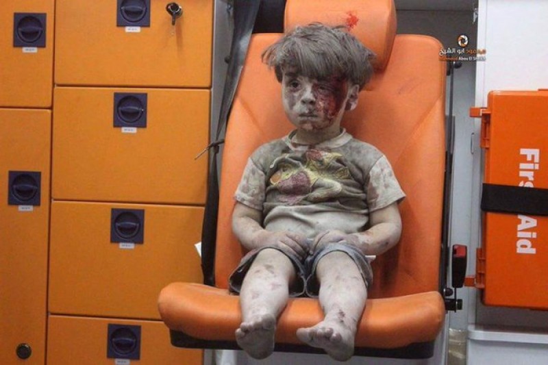 Omran Daqneesh, bé trai 5 tuổi người Syria, là một trong hàng trăm nghìn em nhỏ khác phải chịu đựng nỗi đau cả về thể xác lẫn tinh thần trong cuộc chiến tại Syria. Bức ảnh chụp vào ngày 17/8/2016 và được phát tán rộng rãi trên mạng xã hội ngay sau đó.