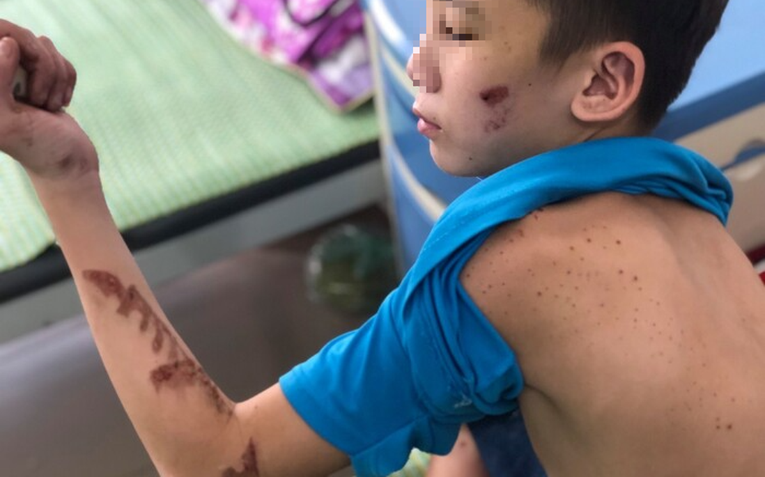 Hội LHPN tỉnh Bắc Ninh lên tiếng bảo vệ quyền lợi cho bé trai bị hành hạ ở quán bánh xèo miền Trung