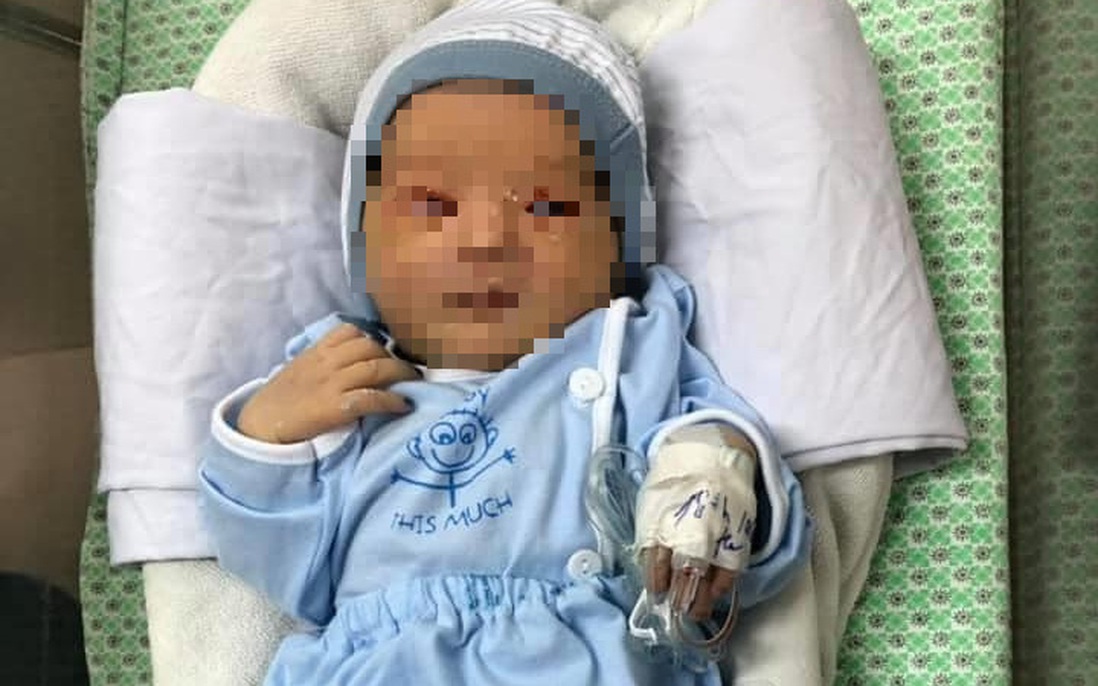 Em bé bị mẹ bỏ rơi ở hố ga: Mắt và tai không bị tổn thương nghiêm trọng