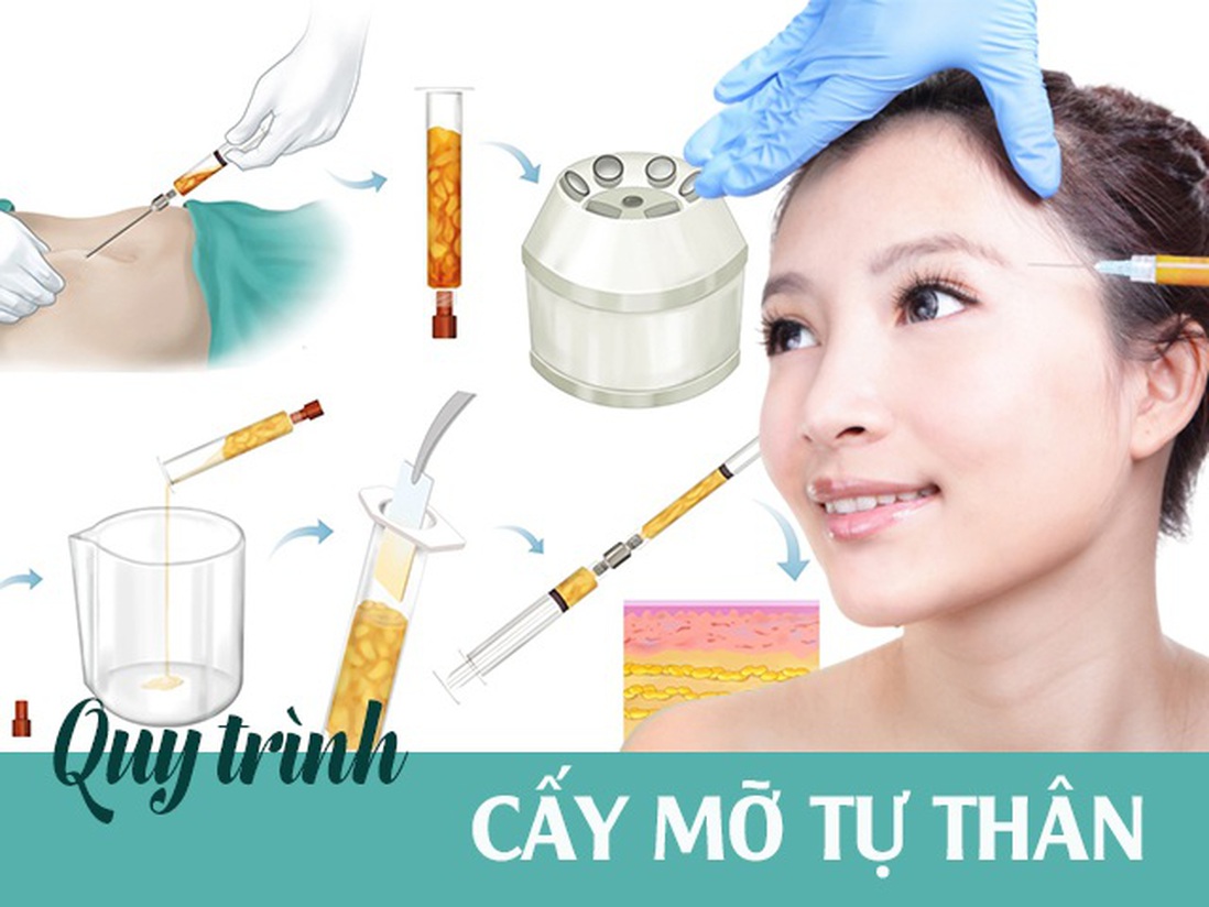 "Mục sở thị” quy trình cấy mỡ tự thân: Nàng cần nắm ngay trước khi bước lên bàn hút mỡ