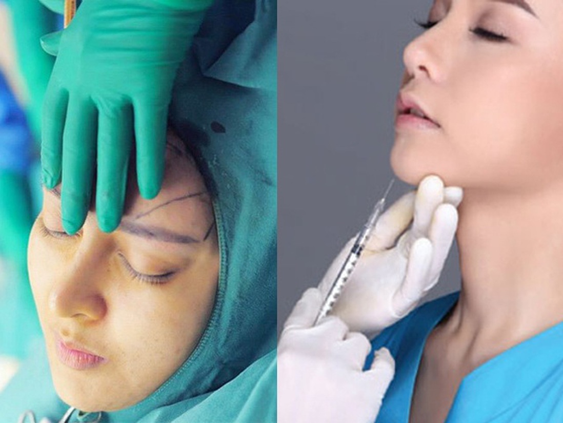 Băn khoăn giữa cấy mỡ tự thân và tiêm filler, nên chọn phương pháp nào làm đẹp gương mặt?