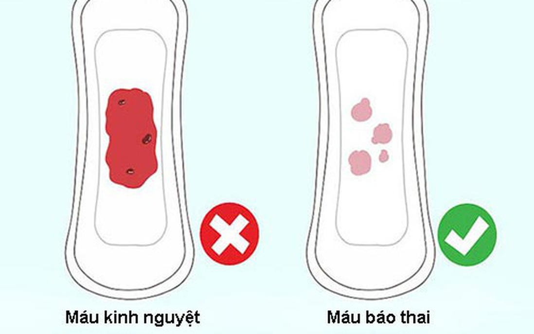 Máu báo thai là gì? Phân biệt giữa máu báo thai và máu kinh nguyệt như thế nào?