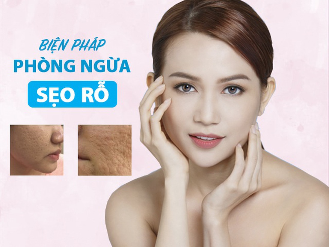 Tuyệt đối không được làm những điều sau để "né" sẹo rỗ