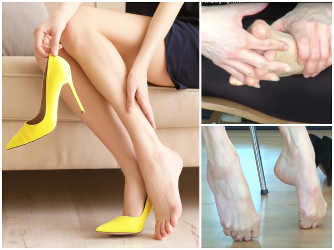 Bài tập giảm đau nhức chân cho những nàng phải đi giày cao gót cả ngày
