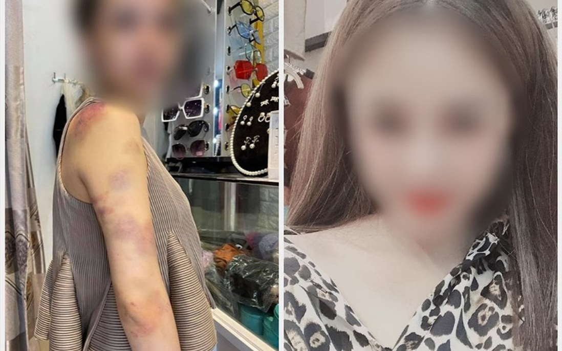 Người chồng bị vợ tố bạo hành ở Yên Bái: "Đúng là tôi có đánh vợ nhưng không nhốt"