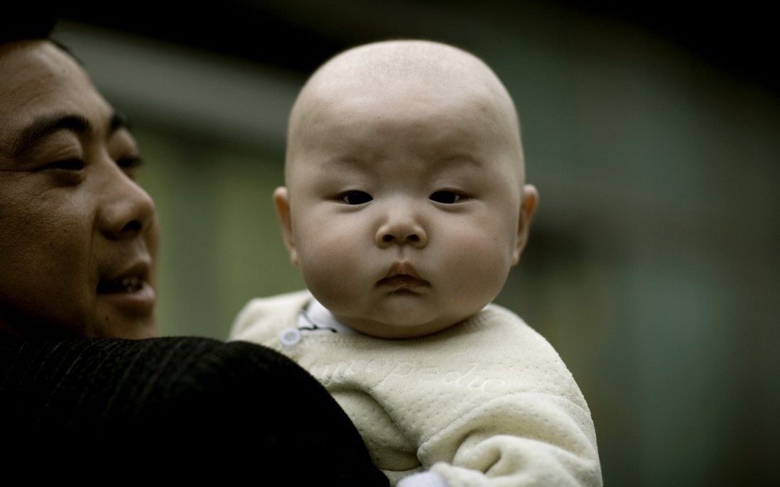 Trung Quốc: Cha mẹ cho bé dùng sản phẩm “chỉnh hình đầu” để có đầu tròn