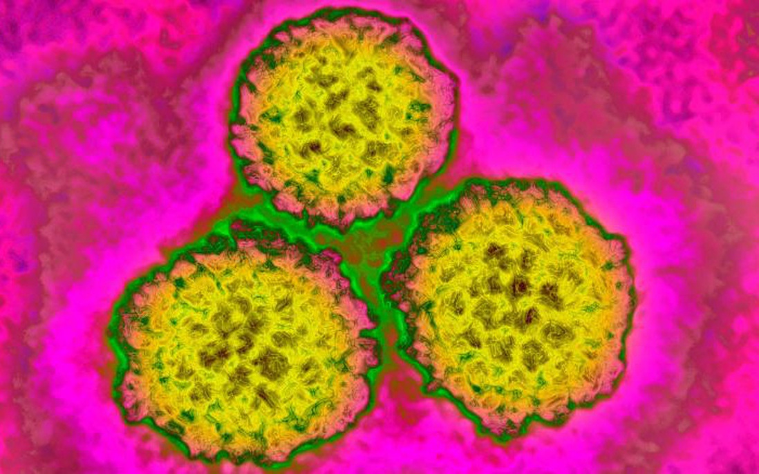 Vaccine HPV có thể giảm tỷ lệ ung thư cổ tử cung tới 87%