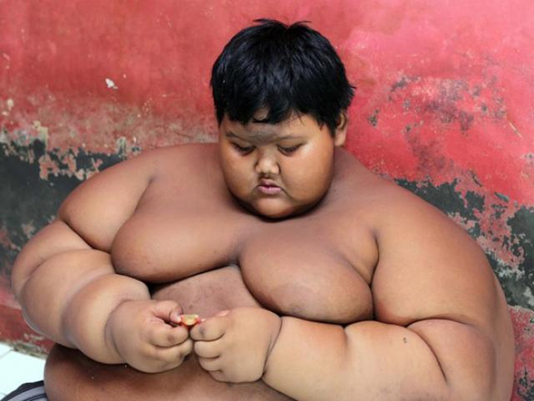 Cậu bé béo nhất thế giới từng nặng gần 200kg thay đổi ngoạn mục sau 3 năm