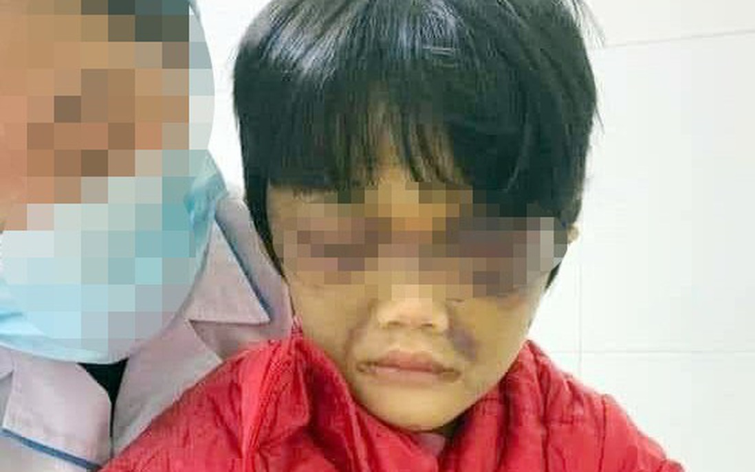 Hội LHPN Hải Dương thông tin chi tiết vụ mẹ bạo hành con gái 6 tuổi ở huyện Cẩm Giàng