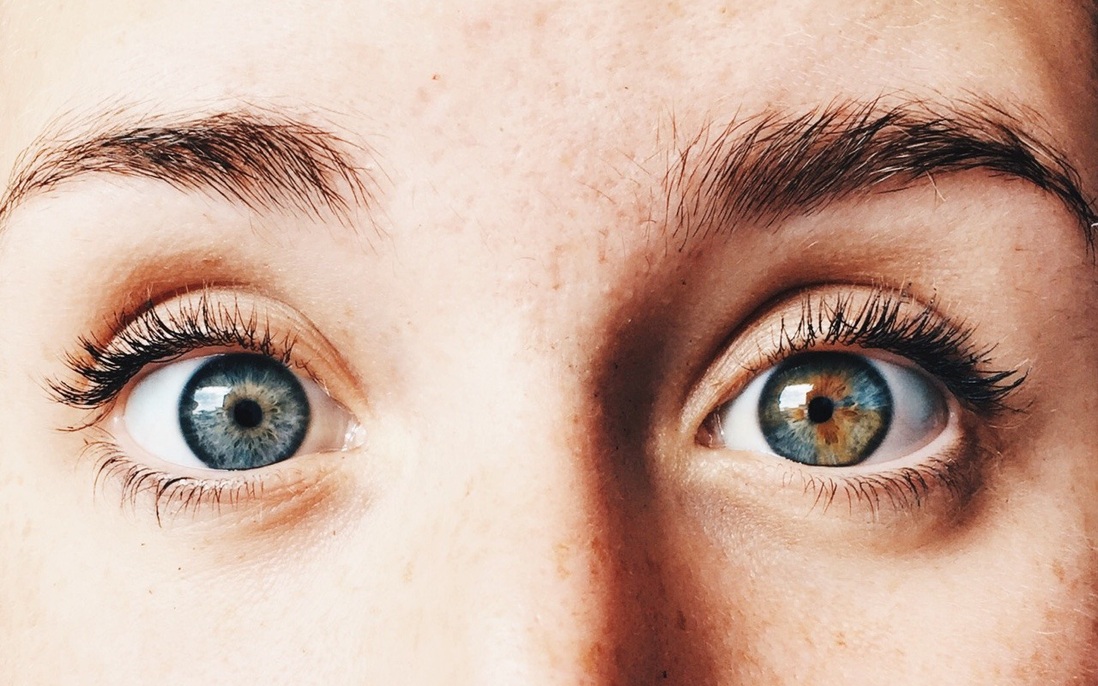 Người bị 2 màu mắt có nguy hiểm không?