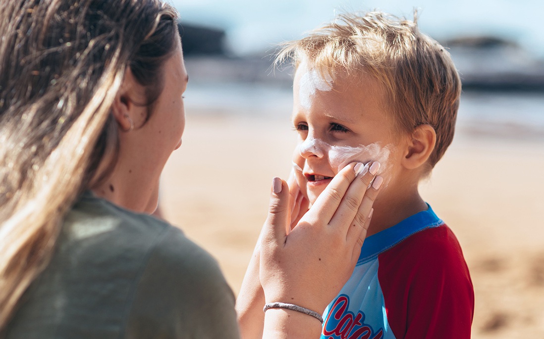 5 điều phụ huynh cần lưu ý khi chăm sóc da cho trẻ mùa hè